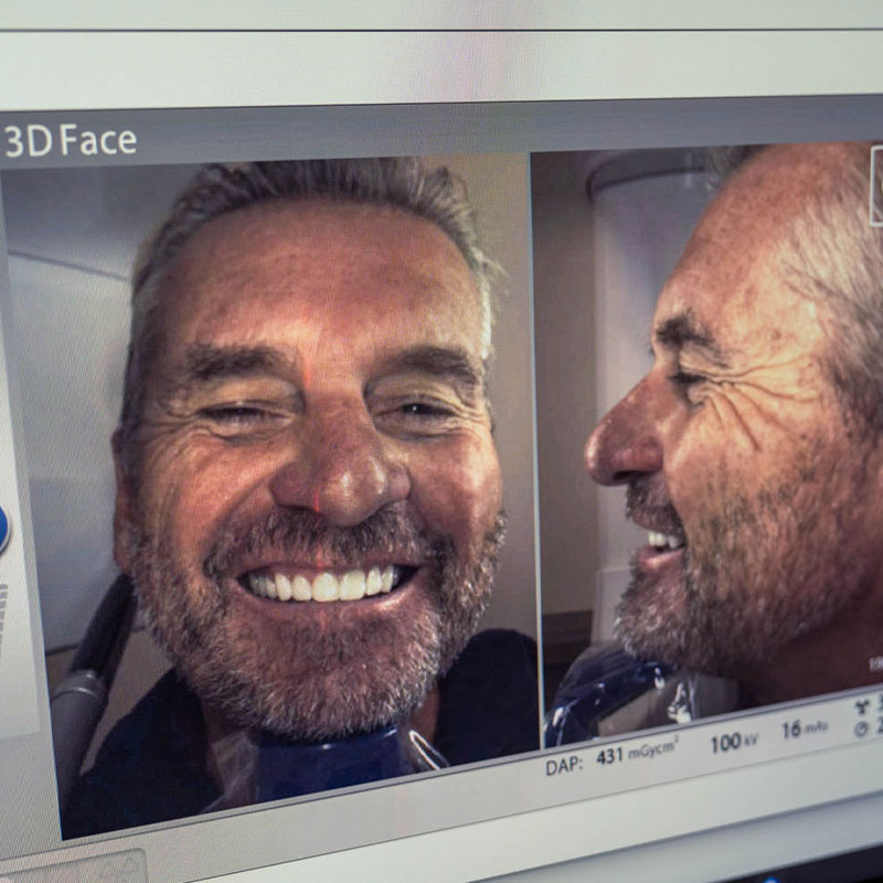 digital 3d scan