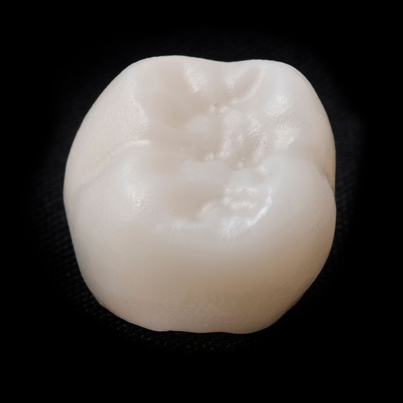 dental crown close up