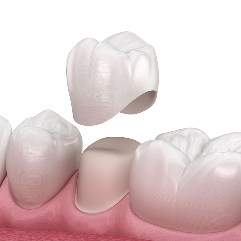 dental crown 3d model