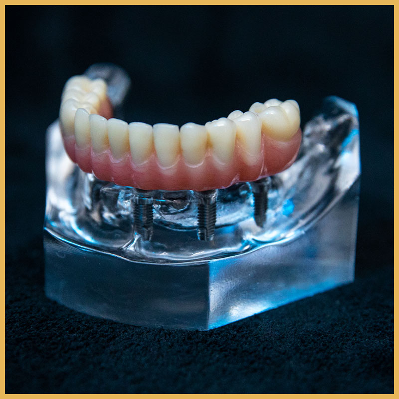 implant cta