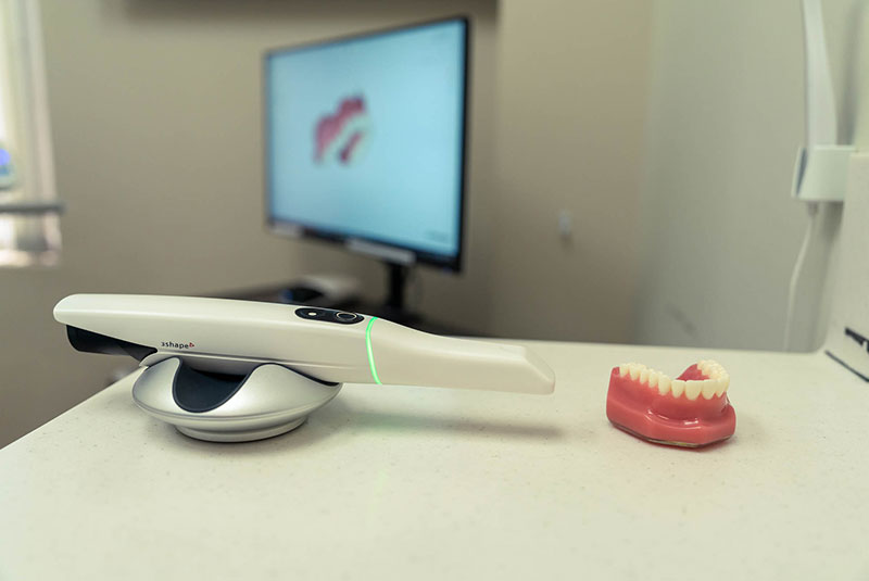 itero scanner screen