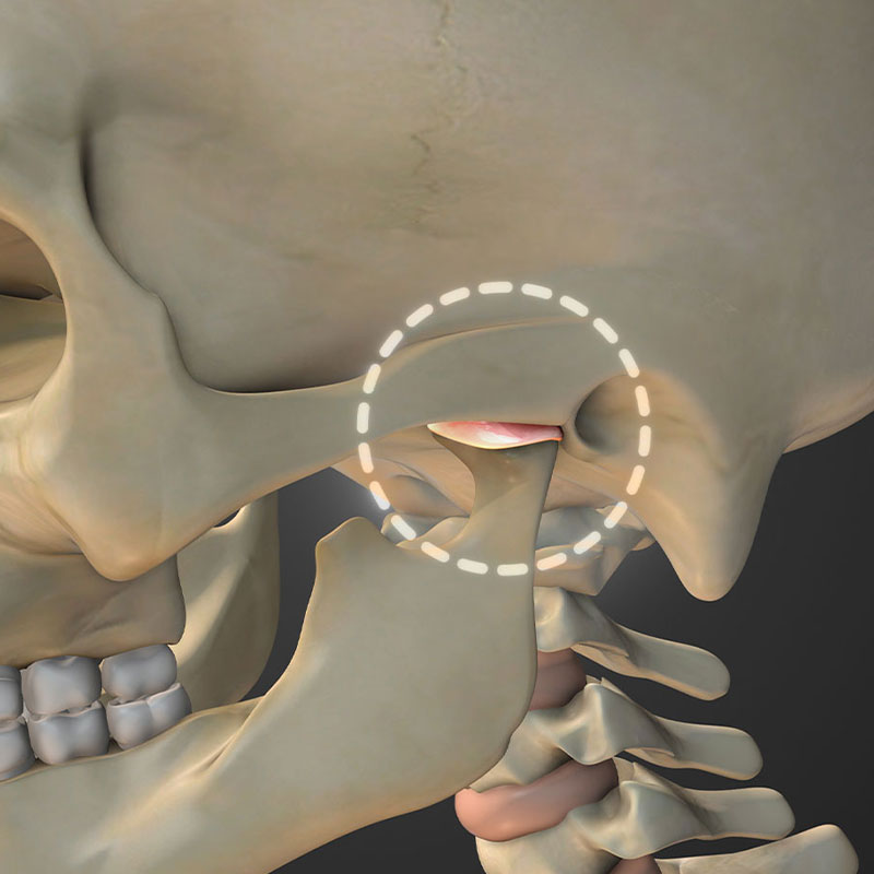tmj pain point